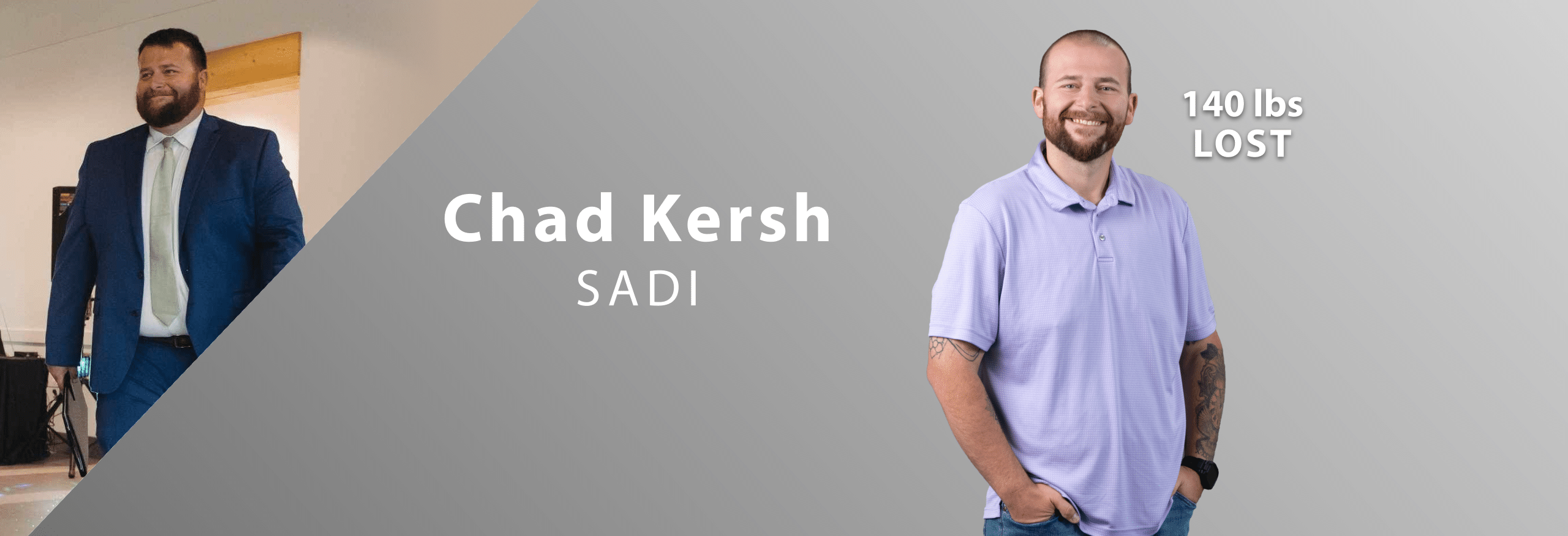 Click the image to learn more about SADI Surgery: Another weight loss tool delivering impressive results